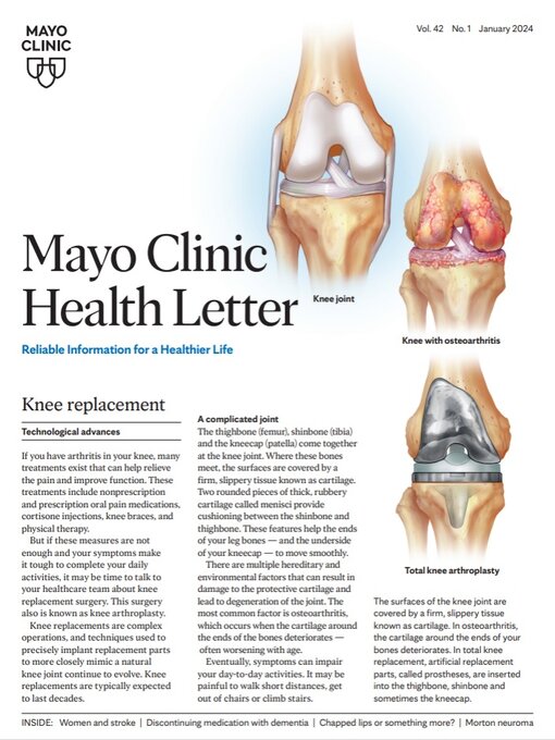 Title details for January 2024. Mayo Clinic Health Letter by Mayo Clinic - Available